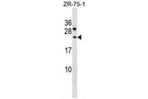 CCDC140 Antibody (N-term) western blot analysis in ZR-75-1 cell line lysates (35µg/lane). (CCDC140 anticorps  (N-Term))