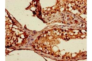 Immunohistochemistry of paraffin-embedded human testis tissue using ABIN7169663 at dilution of 1:100