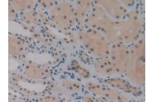 Detection of DFFa in Human Kidney Tissue using Polyclonal Antibody to DNA Fragmentation Factor Subunit Alpha (DFFa)