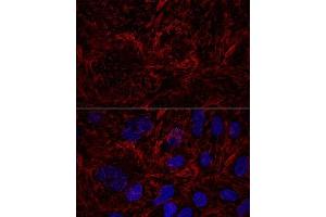 Confocal immunofluorescence analysis of U2OS cells using Septin 9 Polyclonal Antibody (ABIN6129127, ABIN6147560, ABIN6147561 and ABIN6224744) at dilution of 1:100.