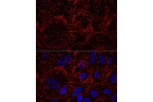 Confocal immunofluorescence analysis of U2OS cells using Septin 9 Polyclonal Antibody (ABIN6129127, ABIN6147560, ABIN6147561 and ABIN6224744) at dilution of 1:100. (Septin 9 anticorps  (AA 1-110))