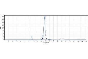 anti-GCGR (Volagidemab Biosimilar) antibody