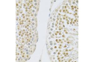 Immunohistochemistry of paraffin-embedded rat testis using SLC39A7 antibody (ABIN5971725) at dilution of 1/100 (40x lens). (SLC39A7 anticorps)