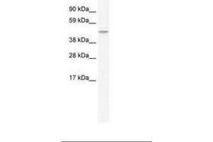 TMEM108 anticorps  (C-Term)