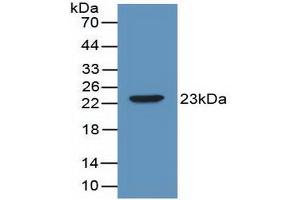 Western blot analysis of recombinant Mouse IL2. (IL-2 anticorps  (AA 10-169))
