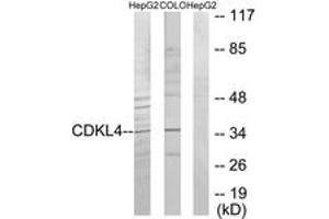 Western blot analysis of extracts from HepG2/COLO205 cells, using CDKL4 Antibody. (CDKL4 anticorps  (AA 266-315))