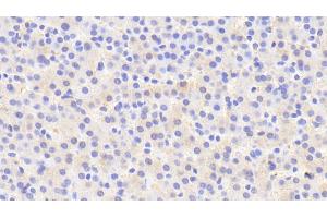 Detection of IDS in Human Liver Tissue using Polyclonal Antibody to Iduronate-2-Sulfatase (IDS) (IDS anticorps  (AA 95-289))