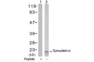 Image no. 1 for anti-Synuclein, alpha (SNCA) (Tyr125) antibody (ABIN197503) (SNCA anticorps  (Tyr125))