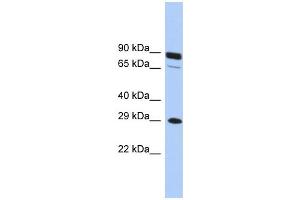 WB Suggested Anti-HOXC5 Antibody Titration:  0. (Homeobox C5 anticorps  (Middle Region))