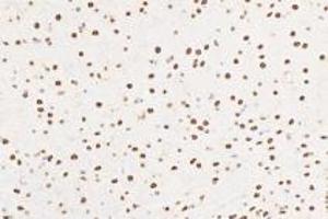 Immunohistochemistry analysis of paraffin-embedded mouse substantia nigra using Ring1A (ABIN7075467) at dilution of 1: 3600