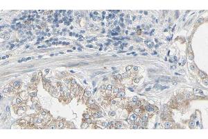 ABIN6277958 at 1/100 staining Human prostate tissue by IHC-P. (GNB2 anticorps  (C-Term))