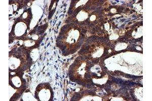 Image no. 4 for anti-NADH Dehydrogenase (Ubiquinone) Complex I, Assembly Factor 7 (NDUFAF7) antibody (ABIN1499667) (NDUFAF7 anticorps)