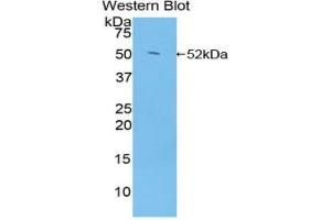 Western blot analysis of the recombinant protein. (Glucocorticoid Receptor anticorps  (AA 564-733))