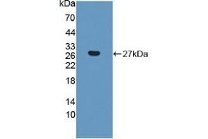 Detection of Recombinant CTHRC1, Human using Polyclonal Antibody to Collagen Triple Helix Repeat Containing Protein 1 (CTHRC1) (CTHRC1 anticorps  (AA 31-243))