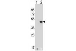 Western blot analysis of EIF4A2 (arrow) using rabbit polyclonal EIF4A2 Antibody (C-term) . (EIF4A2 anticorps  (C-Term))