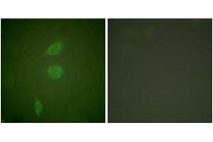 Immunofluorescence analysis of NIH-3T3 cells, using HDAC5 Antibody.