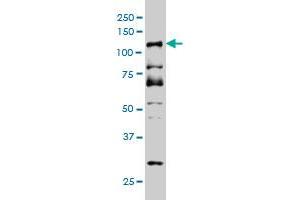 DMTF1 monoclonal antibody (M03), clone 5C6 Western Blot analysis of DMTF1 expression in Hela S3 NE .