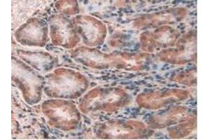 IHC-P analysis of Human Kidney Tissue, with DAB staining. (CLIC1 anticorps  (AA 79-241))