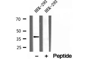 Western blot analysis of extracts of HEK-293 cells, using CLTA antibody. (CLTA anticorps)