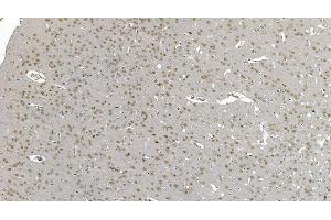 IHC analysis of DDX1 using anti-DDX1 antibody (ABIN7602051).