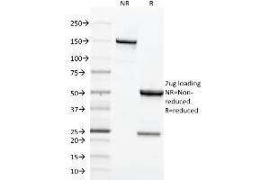 SDS-PAGE Analysis Purified CD71 Mouse Monoclonal Antibody (TFRC/1818). (Transferrin Receptor anticorps  (AA 94-212))