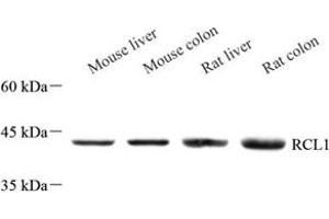 Western blot analysis of RCL1 (ABIN7075482) at dilution of 1: 500 (RCL1 anticorps)