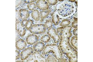 Immunohistochemistry of paraffin-embedded rat kidney using CDH16 antibody.