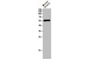 Western blot analysis of mouse-brain lysis using MMP-13 antibody. (MMP13 anticorps  (N-Term))