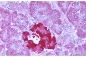 Human Pancreas: Formalin-Fixed, Paraffin-Embedded (FFPE) (FFAR1 anticorps  (Cytoplasmic Domain))