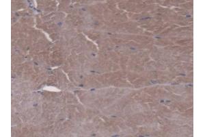 IHC-P analysis of Mouse Skeletal muscle Tissue, with DAB staining. (FPGS anticorps  (AA 210-439))
