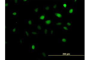 Immunofluorescence of purified MaxPab antibody to ANKRD1 on HeLa cell. (ANKRD1 anticorps  (AA 1-319))