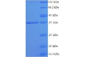 SDS-PAGE (SDS) image for Asparaginase Homolog (ASPG) (AA 24-205) protein (His-SUMO Tag) (ABIN5709007)