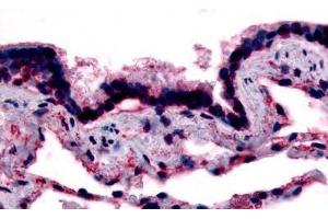 Human Respiratory Epithelium, Bronchial Smooth Muscle, and Alveoli (formalin-fixed, paraffin-embedded) stained with CAV1 antibody ABIN213407 at 15-20 ug/ml followed by biotinylated goat anti-rabbit IgG secondary antibody ABIN481713, alkaline phosphatase-str . (Caveolin-1 anticorps  (N-Term))