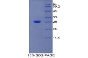 SDS-PAGE (SDS) image for Carcinoembryonic Antigen Gene Family (CEA) (AA 544-771) protein (His tag) (ABIN1525379) (CEA Protein (AA 544-771) (His tag))