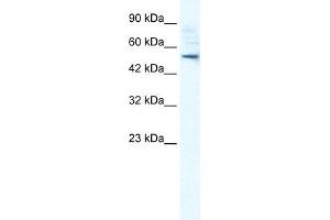 SMPDL3B antibody used at 1 ug/ml to detect target protein. (SMPDL3B anticorps  (N-Term))