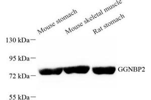 Western blot analysis of GGNBP2 (ABIN7074017) at dilution of 1: 1000 (GGNBP2 anticorps)