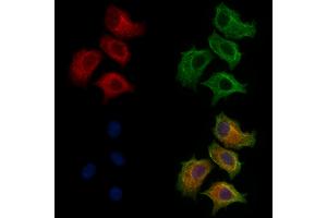 ABIN7094259 and ABIN7098306 staining HepG2 cells by IF/ICC. (GLTP anticorps  (Internal Region))