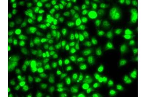 Immunofluorescence analysis of A549 cells using ETS2 antibody. (ETS2 anticorps)