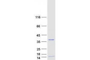 Validation with Western Blot