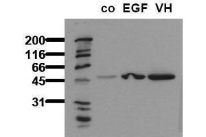 Western Blotting (WB) image for anti-Glycogen Synthase Kinase 3 alpha (GSK3a) (pSer21) antibody (ABIN126804) (GSK3 alpha anticorps  (pSer21))