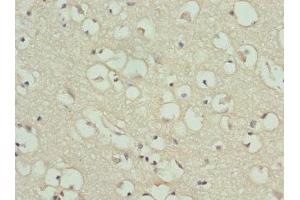 Immunohistochemistry of paraffin-embedded human brain tissue using ABIN7154206 at dilution of 1:100