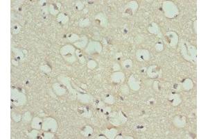 Immunohistochemistry of paraffin-embedded human brain tissue using ABIN7154206 at dilution of 1:100 (PYGB anticorps  (AA 6-843))