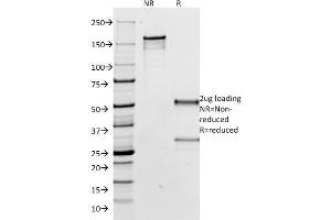 SDS-PAGE Analysis Purified IgG Mouse Monoclonal Antibody (IG266). (IGHG anticorps  (CF®488A))