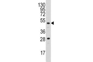 Western blot analysis of Urokinase antibody and A2058 lysate (PLAU anticorps  (AA 60-90))