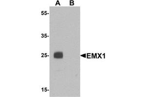 Western blot analysis of EMX1 in rat liver tissue lysate with EMX1 antibody at 1 ug/mL in (A) the absence and (B) the presence of blocking peptide.