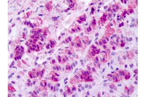 Anti-SLC1 / MCHR1 antibody IHC of human adrenal.