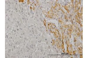 Immunoperoxidase of monoclonal antibody to CREB5 on formalin-fixed paraffin-embedded human adrenal gland. (CREB5 anticorps  (AA 1-99))