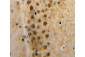 Used in DAB staining on fromalin fixed paraffin-embedded Brain tissue (Axin anticorps  (AA 653-862))