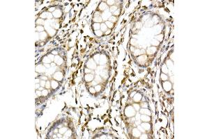 Immunohistochemistry of paraffin-embedded human colon using Cullin 1 Rabbit pAb (ABIN3015863, ABIN3015864, ABIN3015865 and ABIN6219345) at dilution of 1:50 (40x lens).