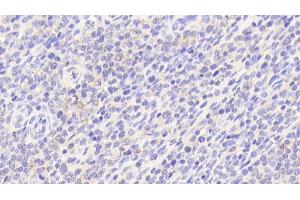 anti-Polymerase (DNA Directed), gamma (POLG) (AA 1041-1239) antibody